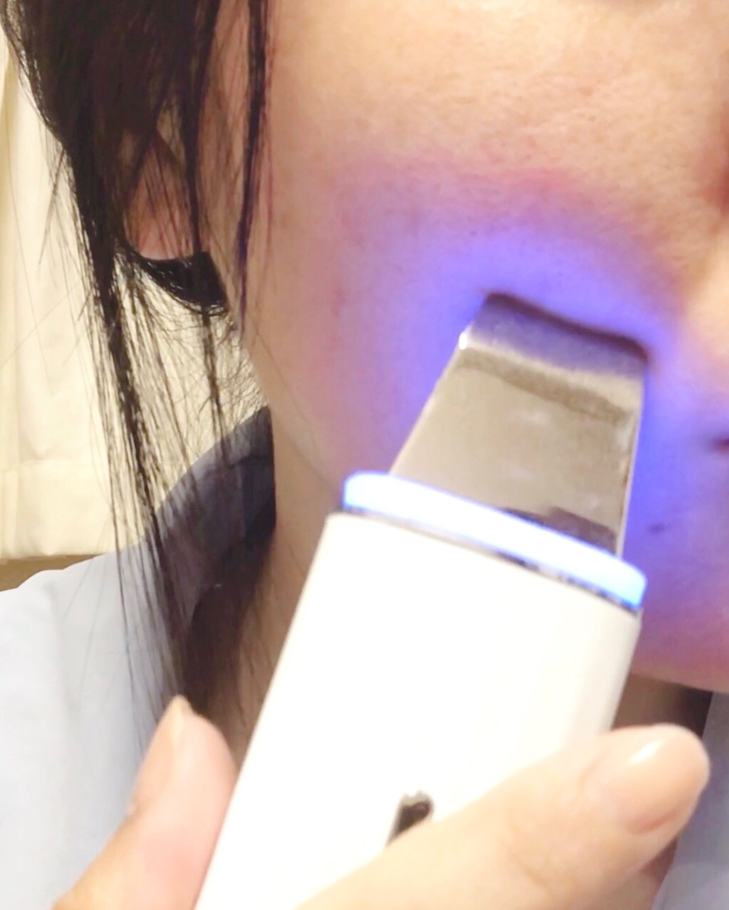 ロイヤル ウォーターピーリング IPX7完全防水/ANLAN/美顔器・マッサージを使ったクチコミ（2枚目）