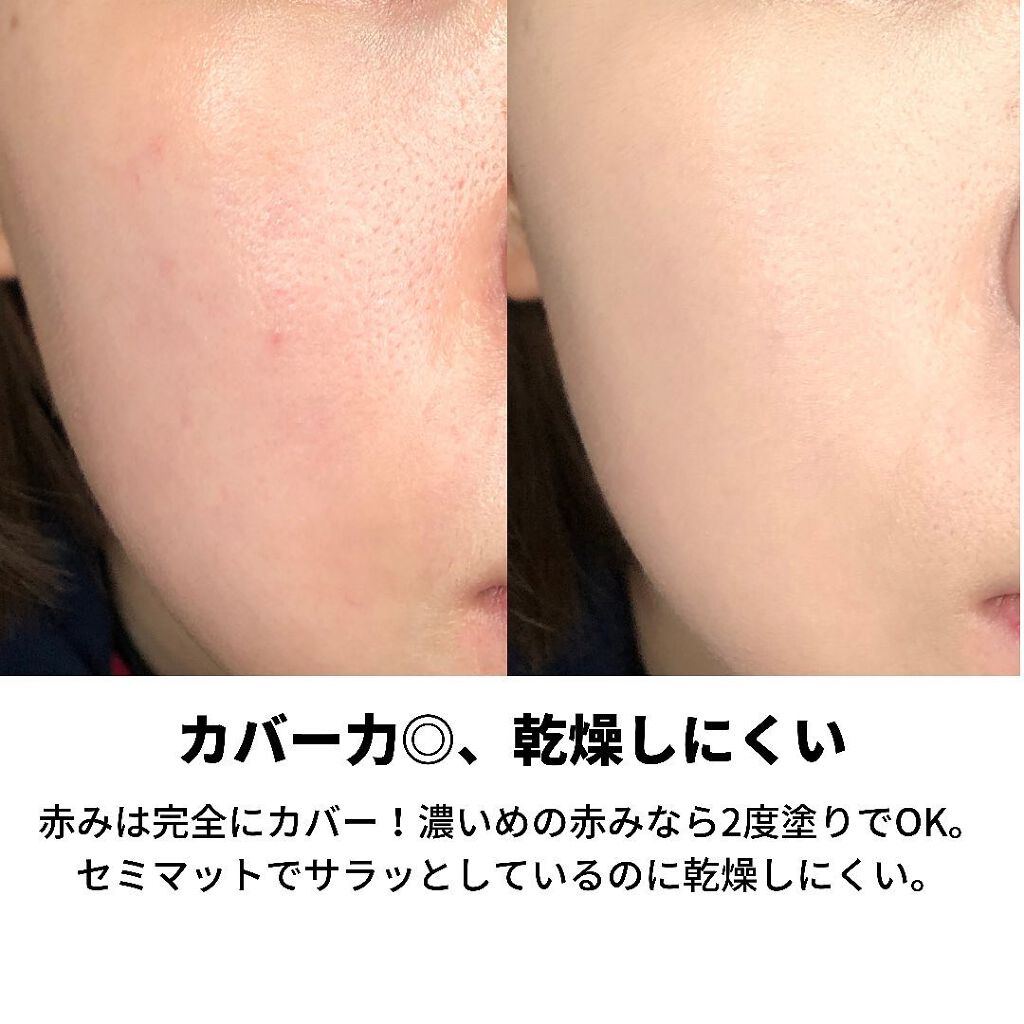 あずさ@スキンケアマニア on LIPS 「これぞ韓国女優肌.#biohealboh#PROBIODERM..」(4枚目)