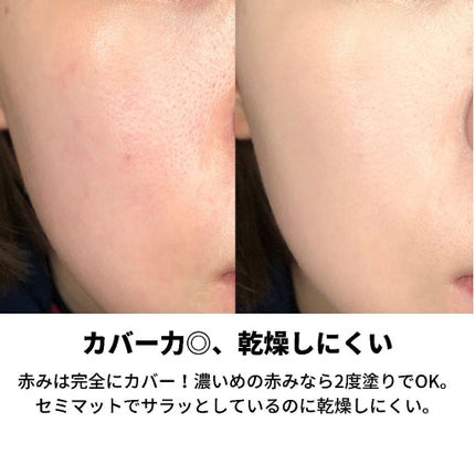 あずさ@スキンケアマニア on LIPS 「これぞ韓国女優肌.#biohealboh#PROBIODERM..」(4枚目)