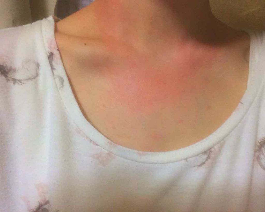 アフターサンウォータージェル/SUNBATH/ボディクリームを使ったクチコミ(2枚目)