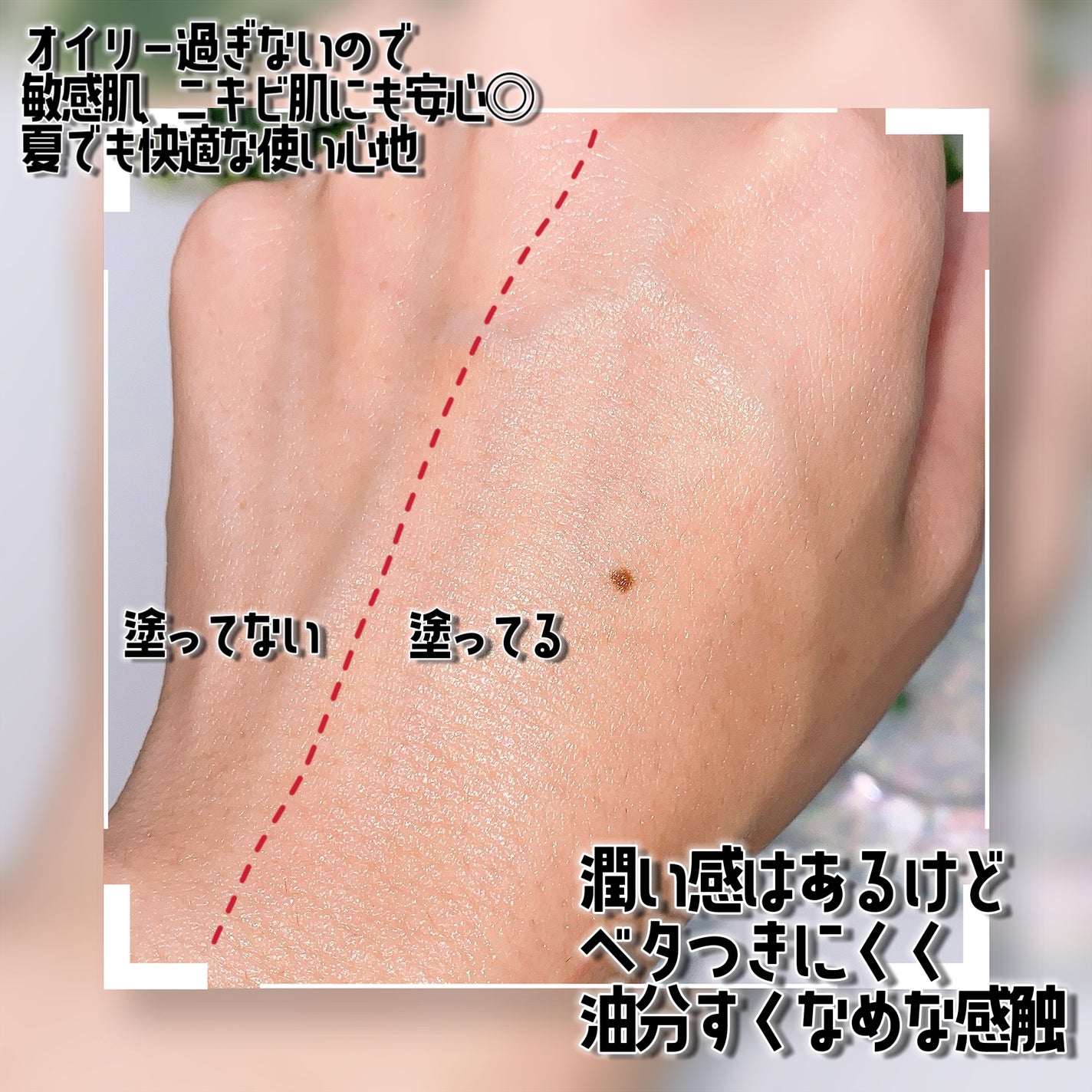 アキュリアルナインコントロールエックスクリーム/ACWELL/フェイスクリームを使ったクチコミ(6枚目)