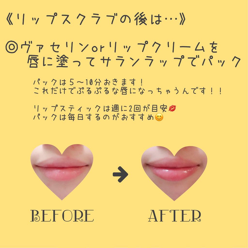 あっぷるぱい on LIPS 「今回は私がいつもしている唇ケア方法を紹介します👏🏻乾燥してがさ..」(3枚目)
