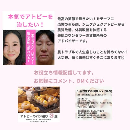 美肌カウンセラー💆肌悩みを解決し見る世界を変える on LIPS 「ズボラ、面倒くさがりなかたにピッタリ重症アトピーの私も使える\..」(6枚目)