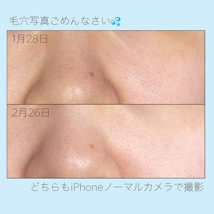 アクアクレンジング/アマルディア/クレンジングジェルを使ったクチコミ(4枚目)