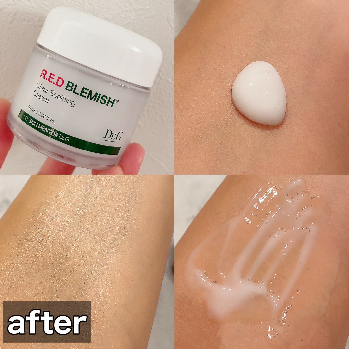 レッドブレミッシュ クリアスージングクリーム/Dr.G/フェイスクリームを使ったクチコミ(2枚目)