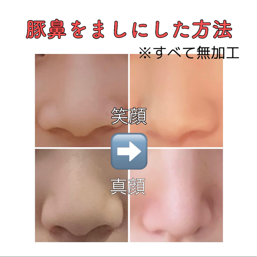 整形なし 鼻プチ で ハーフ顔に変身メイク 整形級 鼻プチ ３サイズ セット ノーズアップ 矯正 整形 Ddsodisha Org