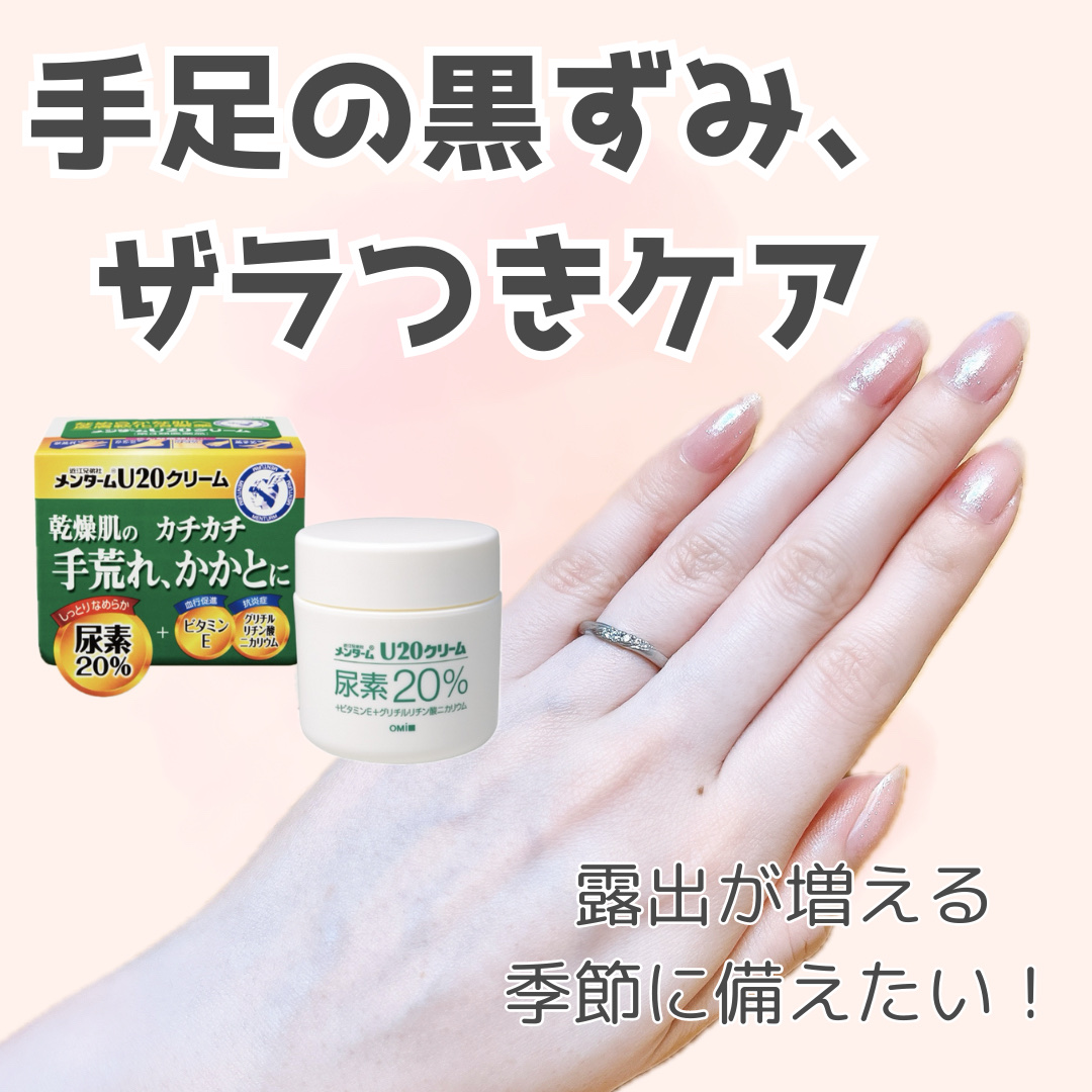 U20クリーム(医薬品)/メンターム/その他を使ったクチコミ（1枚目）