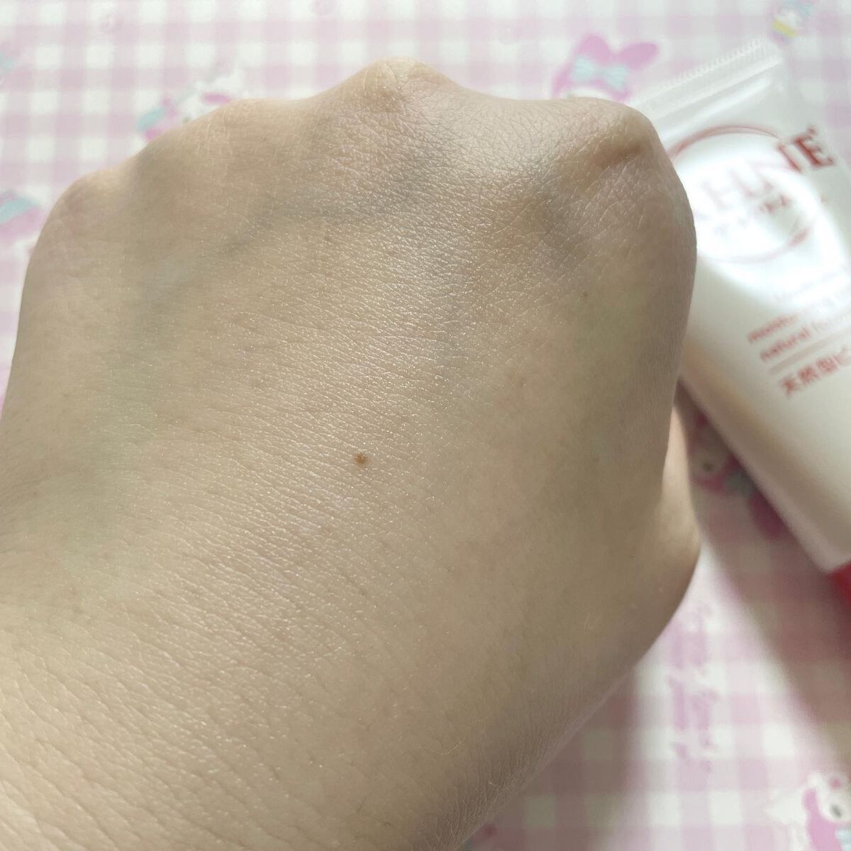 ザーネメディカルクリーム(医薬品)/ザーネ/その他を使ったクチコミ（3枚目）