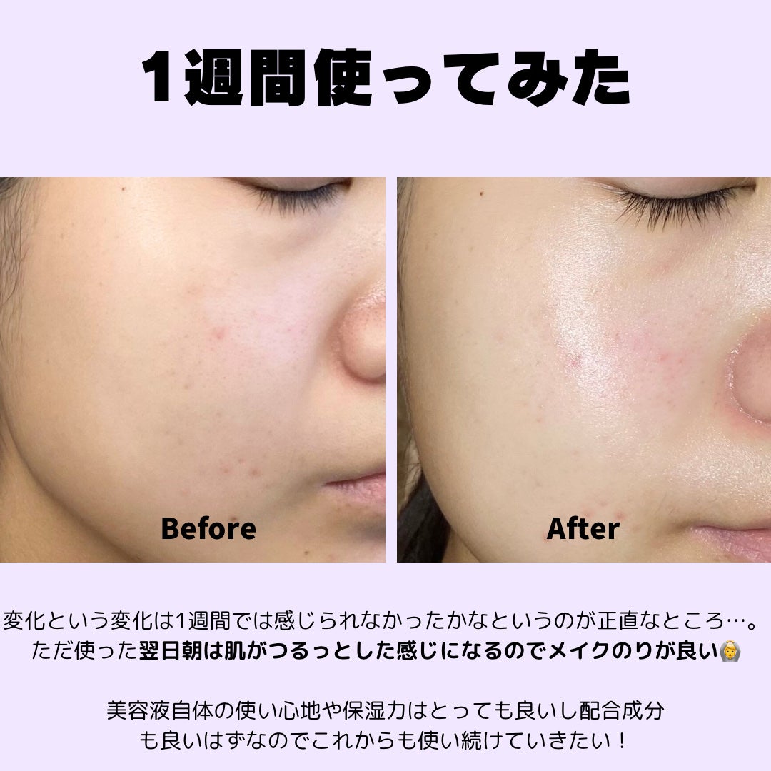 ダーマアンサー PDRN アクティブブースト1:1アンプル/CNP Laboratory/美容液を使ったクチコミ(4枚目)