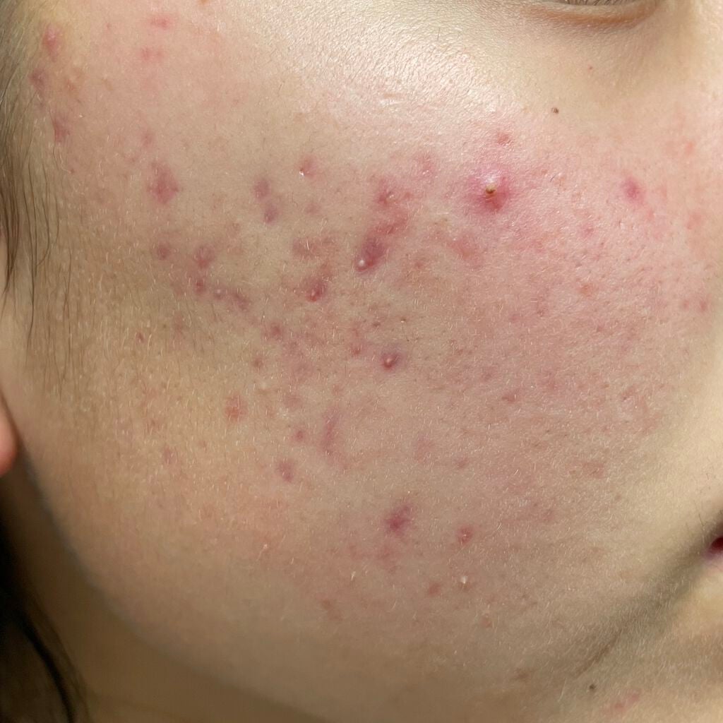 セラキュア センシティブジェリー/CeraLabo/化粧水を使ったクチコミ(1枚目)