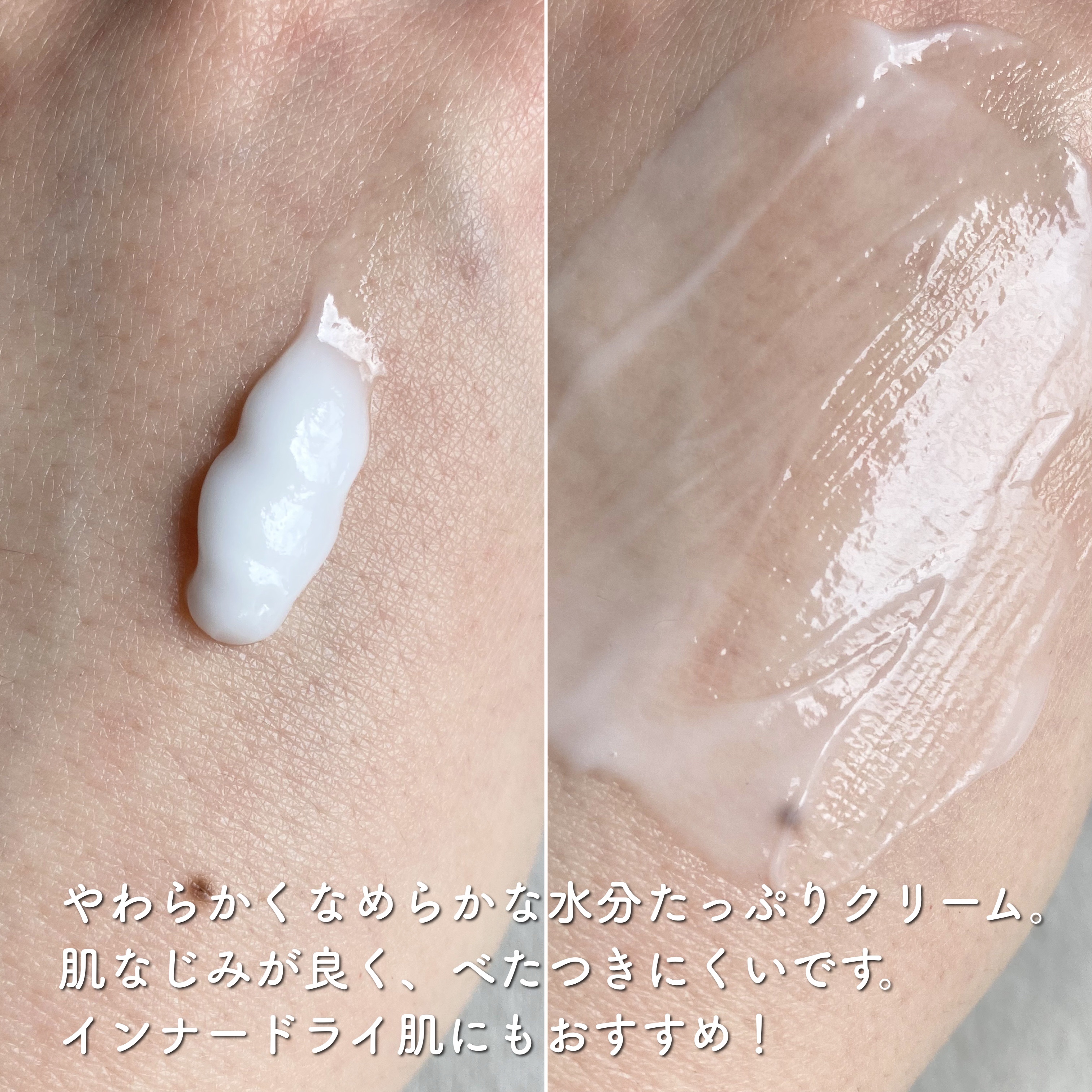 カトクリーム/P.CALM/フェイスクリームを使ったクチコミ（3枚目）