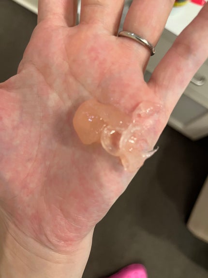 フォームチェンジマスク/APEX/洗い流すパック・マスクを使ったクチコミ(3枚目)