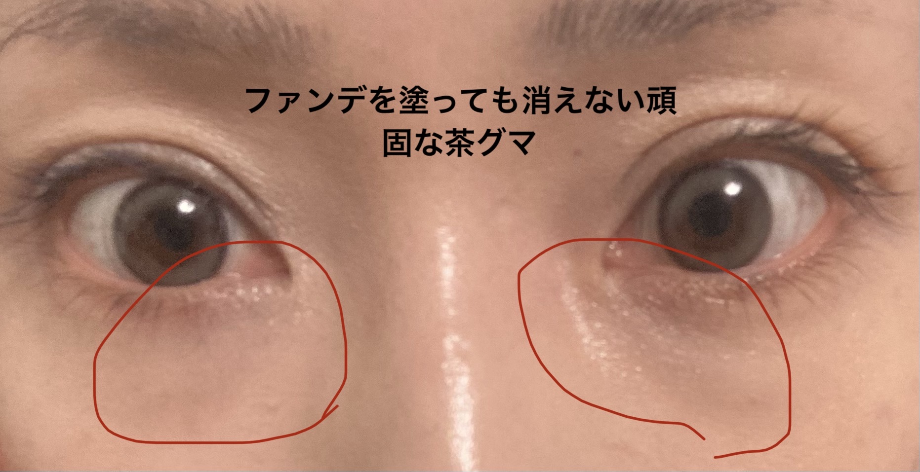 ストレッチコンシーラー/CEZANNE/リキッドコンシーラーを使ったクチコミ（2枚目）