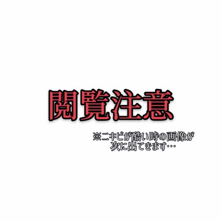 ハトムギ化粧水(ナチュリエ スキンコンディショナー R )/ナチュリエ/化粧水を使ったクチコミ(2枚目)