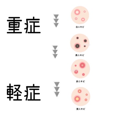 ã䜿ã£ãã¯ãã³ãïŒ2æç®ïŒ