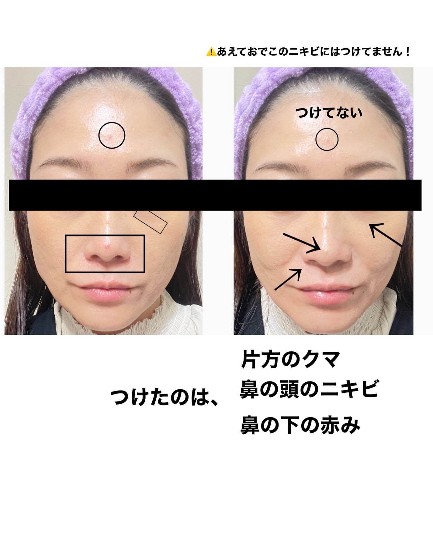 コンシールブレンダーパレット/LUNA/パレットコンシーラーを使ったクチコミ(4枚目)