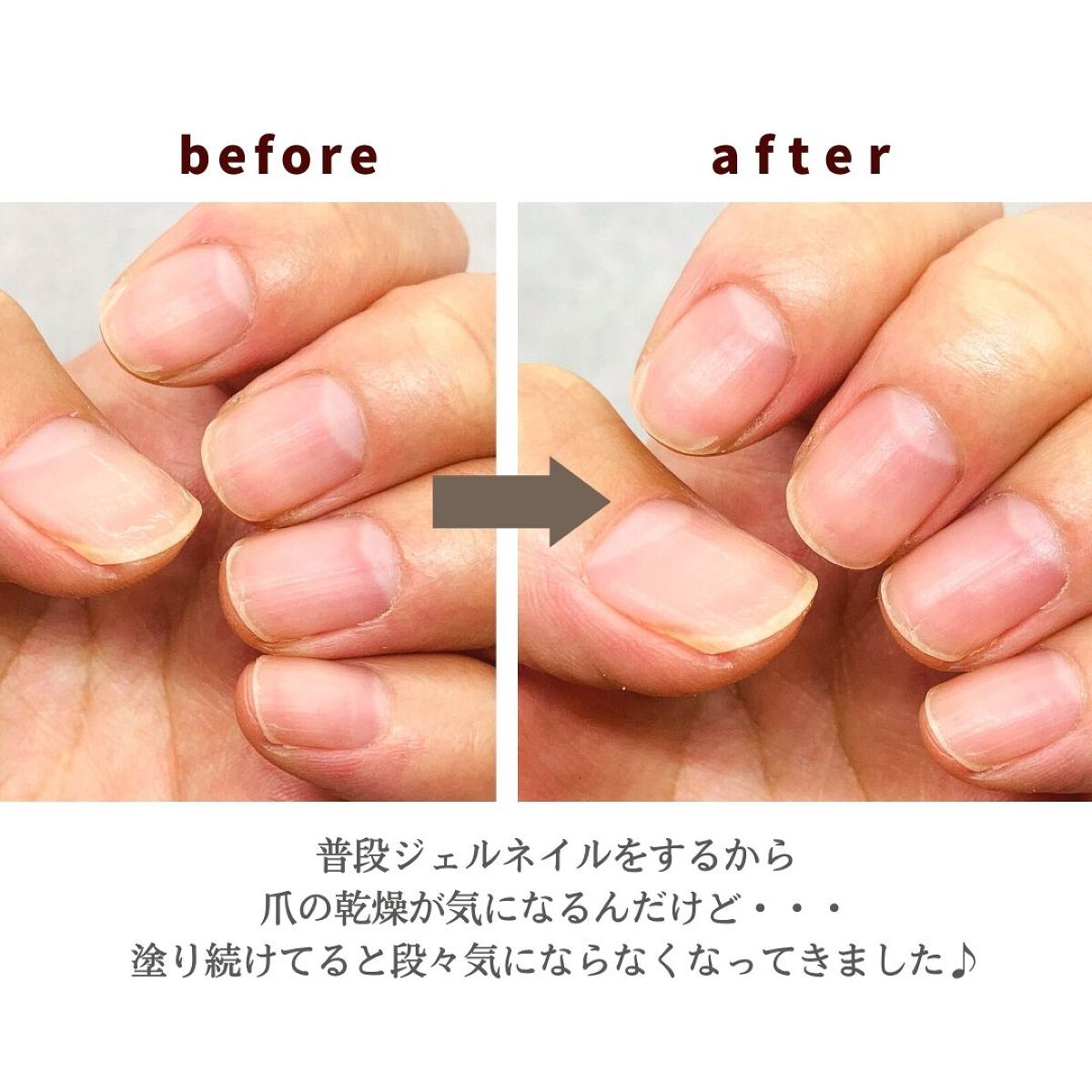 ネイル リペアセラム/ネイル リペアセラム/ネイルオイル・トリートメントを使ったクチコミ（3枚目）
