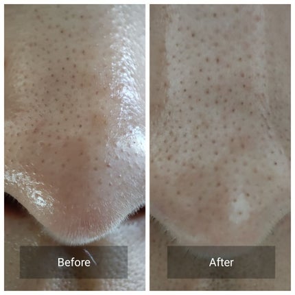 ソフィーナ iP ハリ弾力注入美容液/SOFINA iP/美容液を使ったクチコミ(5枚目)