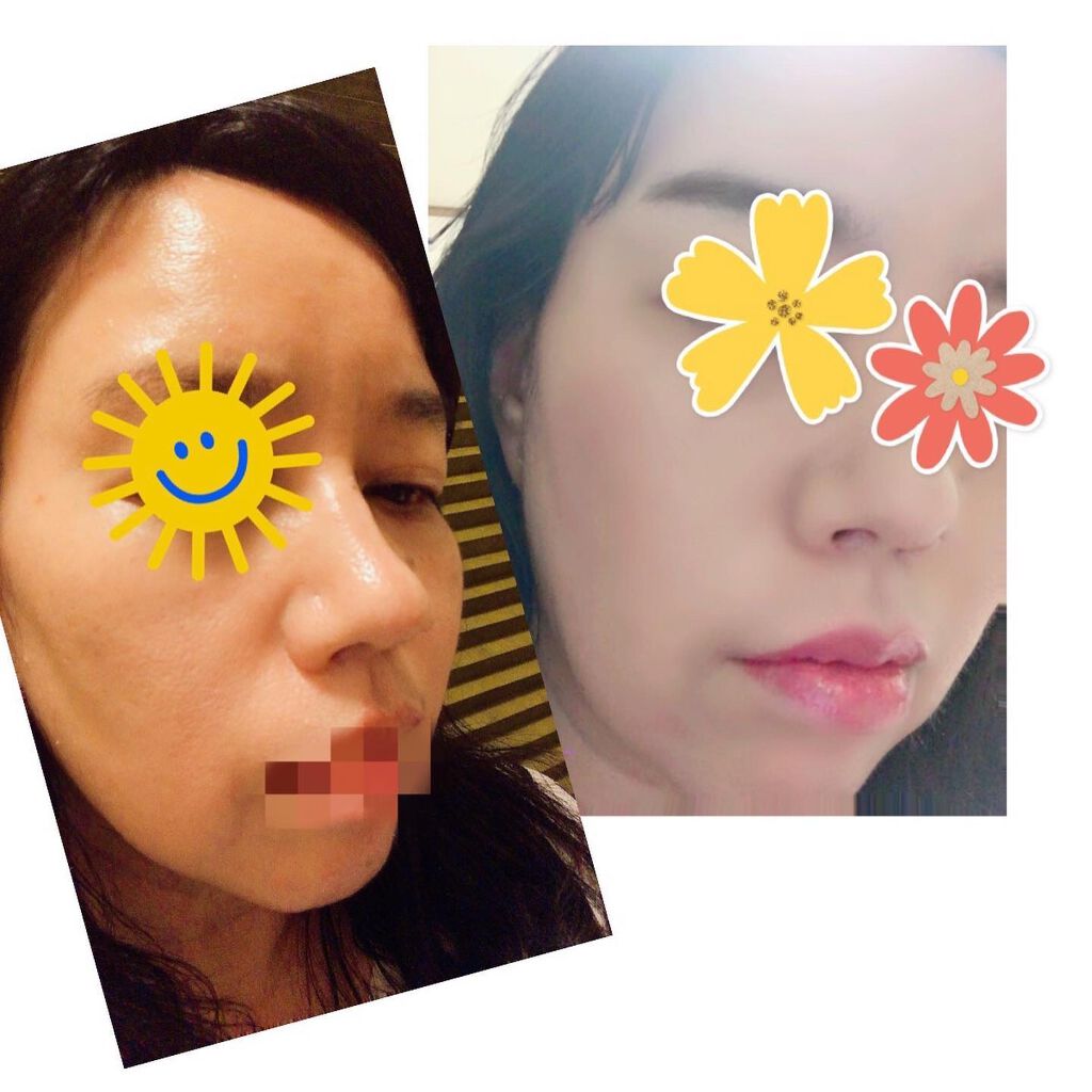 SIWA-KC オールインワンクッション/ハーブ健康本舗/クッションファンデーションを使ったクチコミ(8枚目)