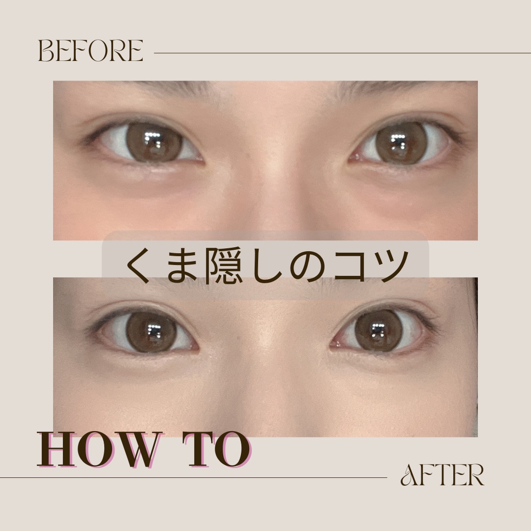 ディオールスキン フォーエヴァー スキン コレクト コンシーラー/Dior/リキッドコンシーラーを使ったクチコミ（1枚目）