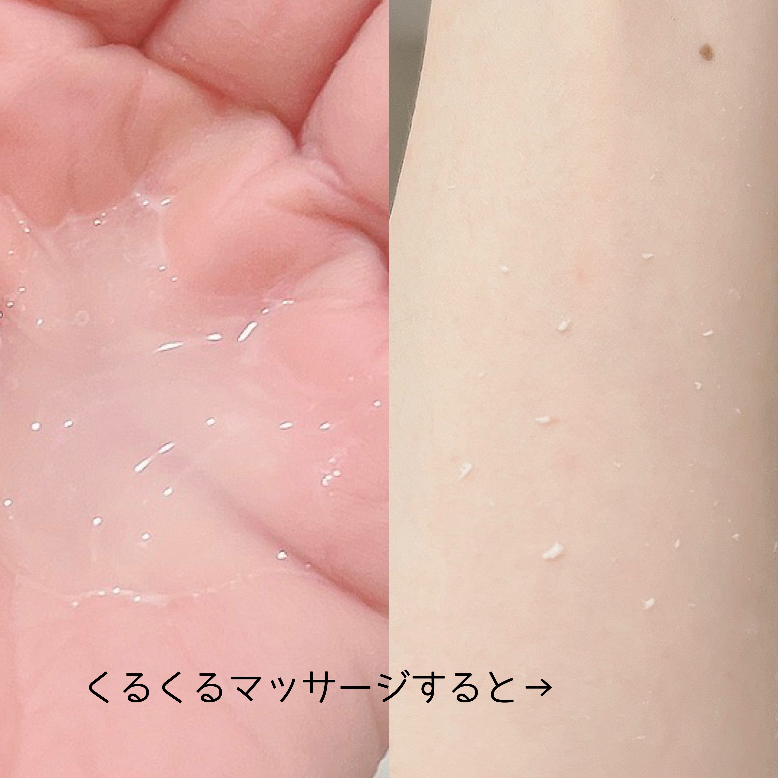 TR50 ピール/MONNALI/ピーリングを使ったクチコミ（2枚目）