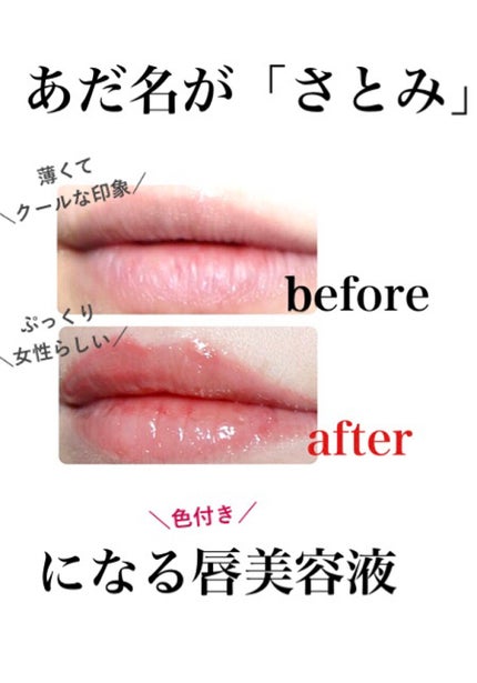 ハニーラスター r/ROAlív/リップグロスを使ったクチコミ(1枚目)