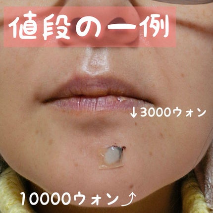 新人ワンコママ★100%フォロバ♡ on LIPS 「韓国在住のワンコママです🐶🐾先日、韓国の普通の皮膚科でホクロ除..」(4枚目)