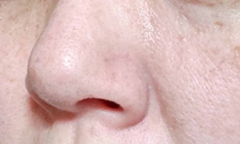 シカバイタル エッセンス/VT/美容液を使ったクチコミ（3枚目）