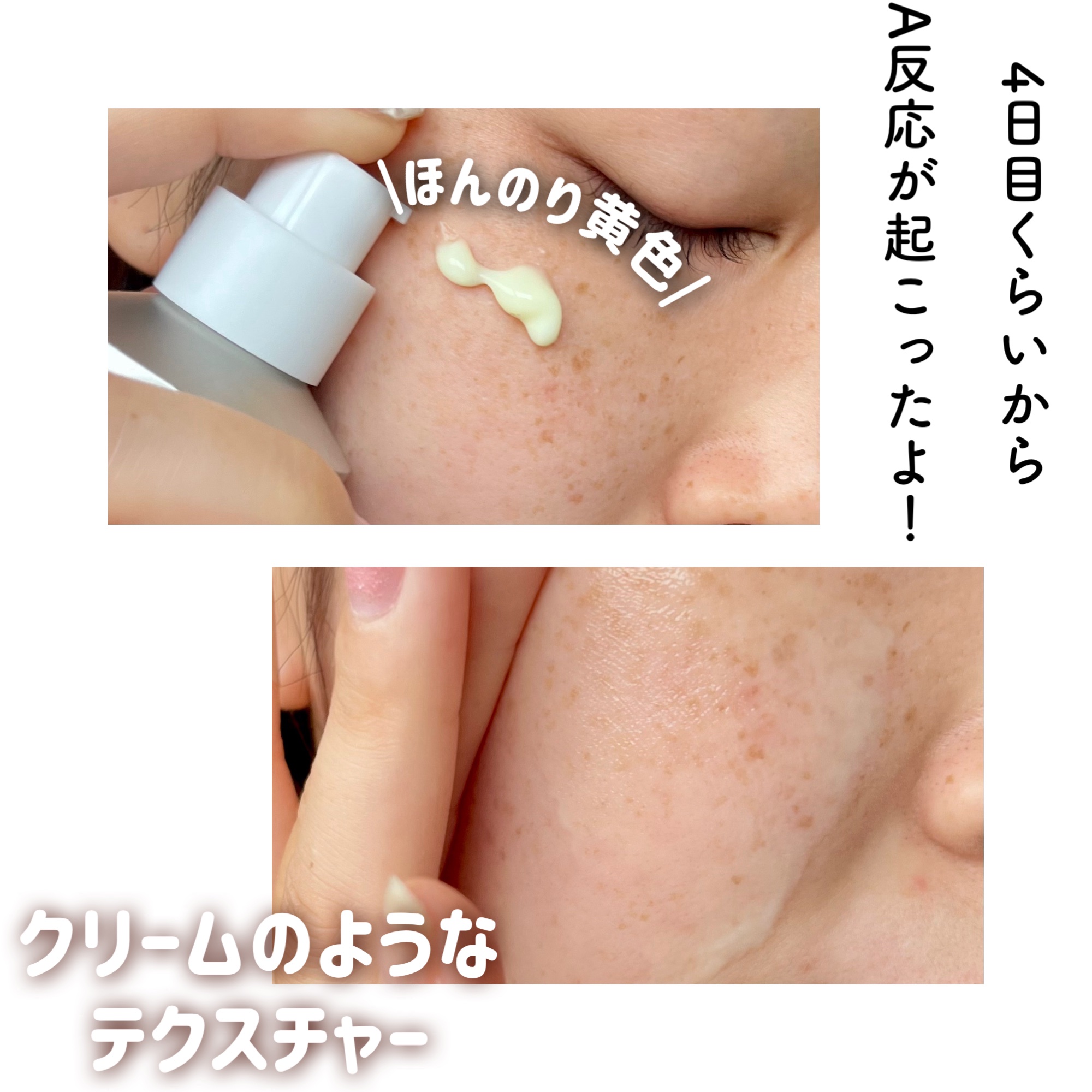 ヴィーガンリポソームレチノールセラム/SKIN&LAB/美容液を使ったクチコミ（3枚目）