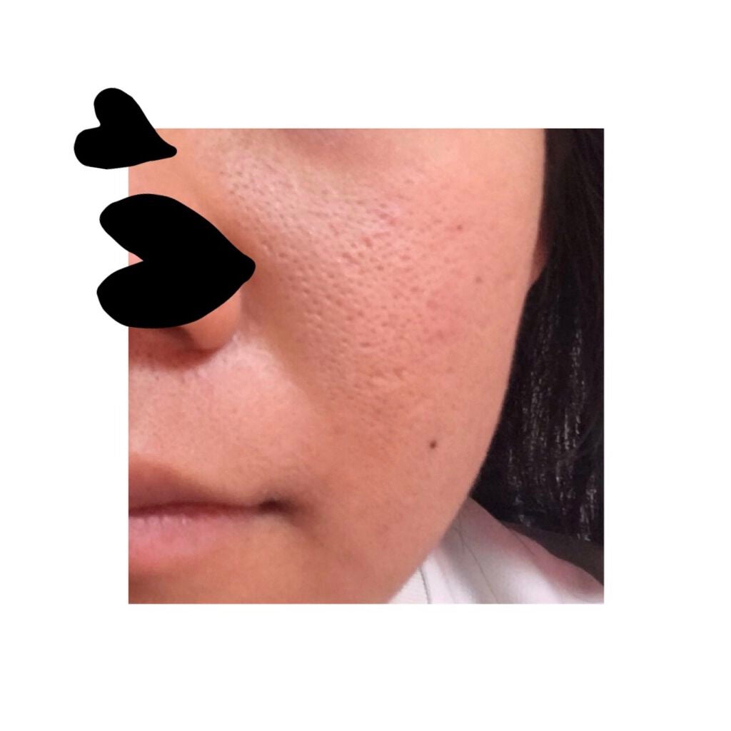 夏帆 on LIPS 「毛穴開き、ニキビ跡で悩んでます。。お風呂の後1⃣オードムーゲの..」(2枚目)