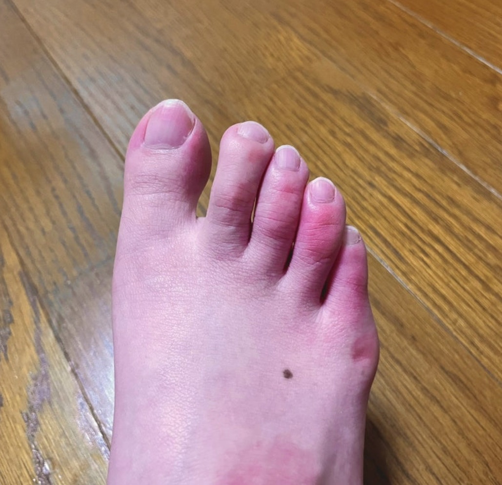 COOLFIN足マッサージ/Briller.Shop.Japan/レッグ・フットケアを使ったクチコミ（3枚目）