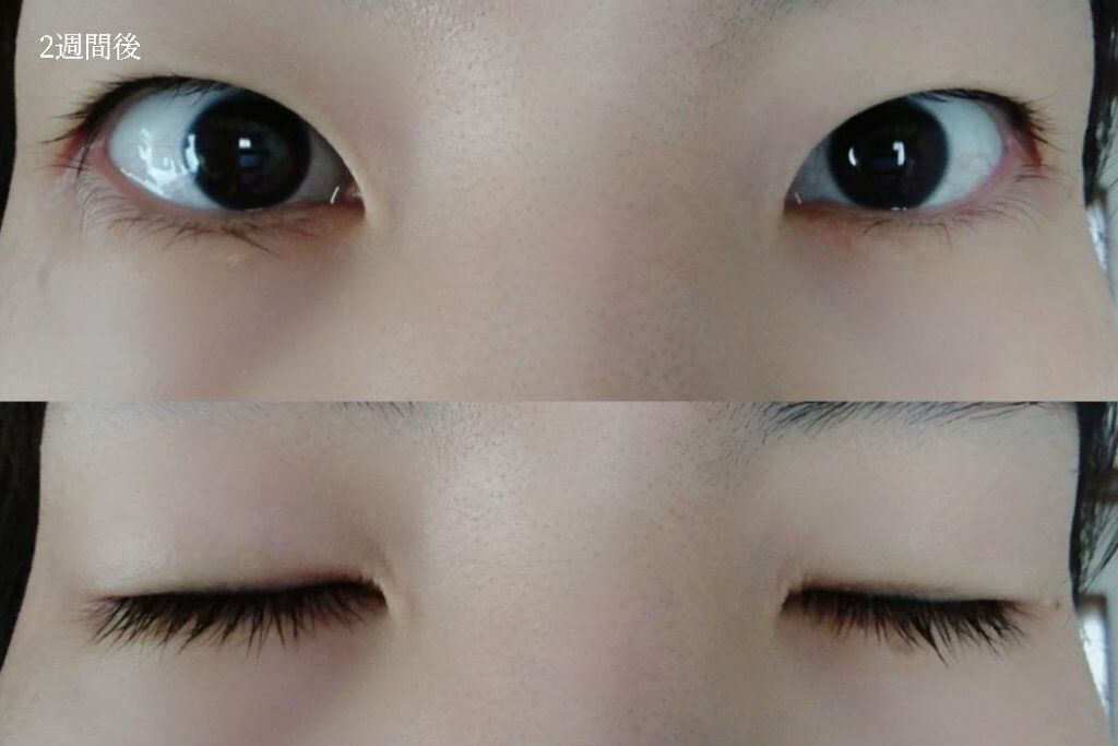 アイラッシュセラム/ルジュ/まつげ美容液を使ったクチコミ(8枚目)