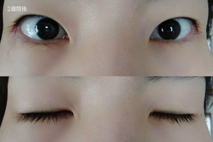 アイラッシュセラム/ルジュ/まつげ美容液を使ったクチコミ(8枚目)