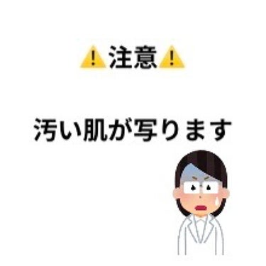 ロゼット ロゼット洗顔パスタ ホワイトダイヤのクチコミ「これが初投稿になります🙏

今現在の私の肌の治安です。
コロナが始まった頃に丁度高校生になった.....」（1枚目）