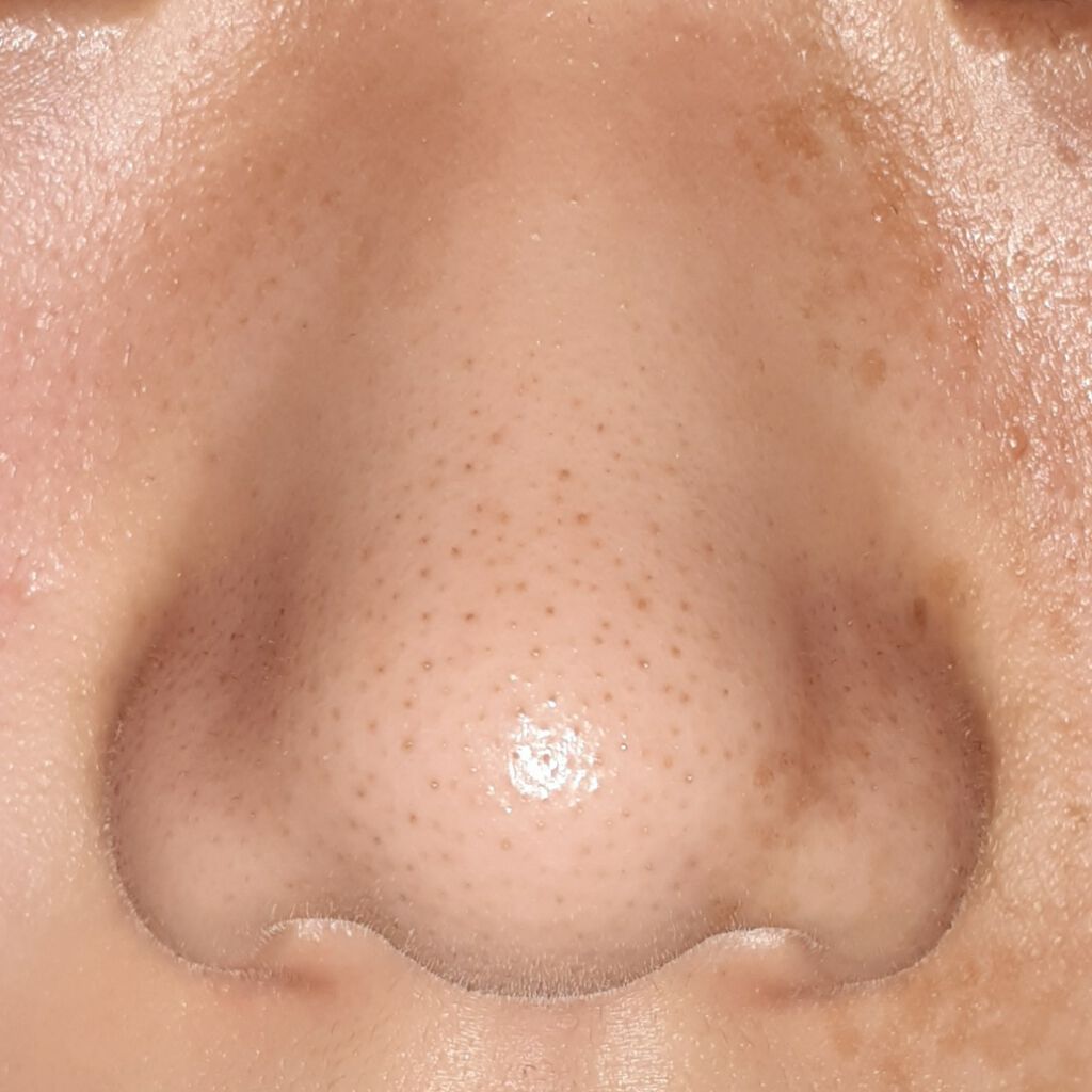 ホワイト もこもこ白泡マスク/リッツ/洗い流すパック・マスクを使ったクチコミ（3枚目）