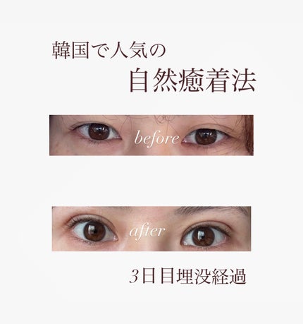 ナイトアイボーテII StreeTrend 二重メイク 美容 アイプチ 化粧品 ナイトアイボーテ / StreeTrendの口コミ | おすすめ順 | 594件