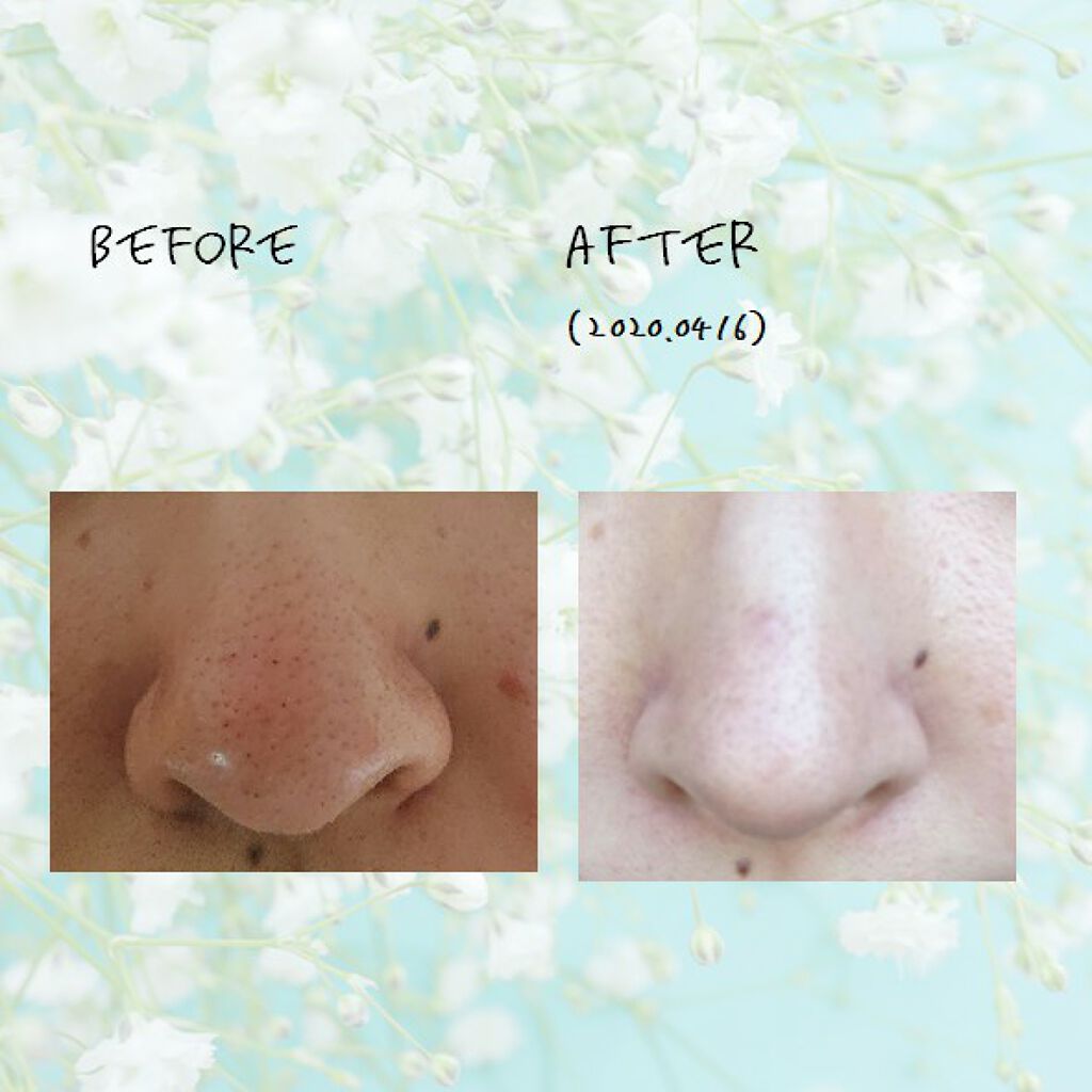 ソンバーユ無香料/尊馬油/ボディオイルを使ったクチコミ(2枚目)