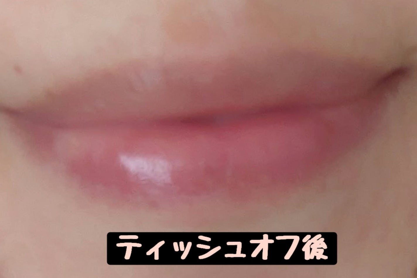 シカティンティッドリップバーム/VT/リップバームを使ったクチコミ(5枚目)