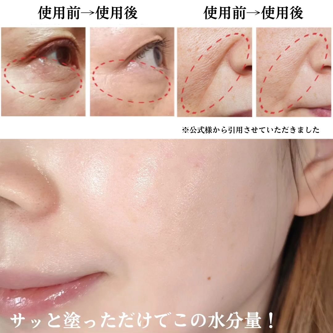 リッドキララ｜北の快適工房の使い方を徹底解説 - 『北の快適