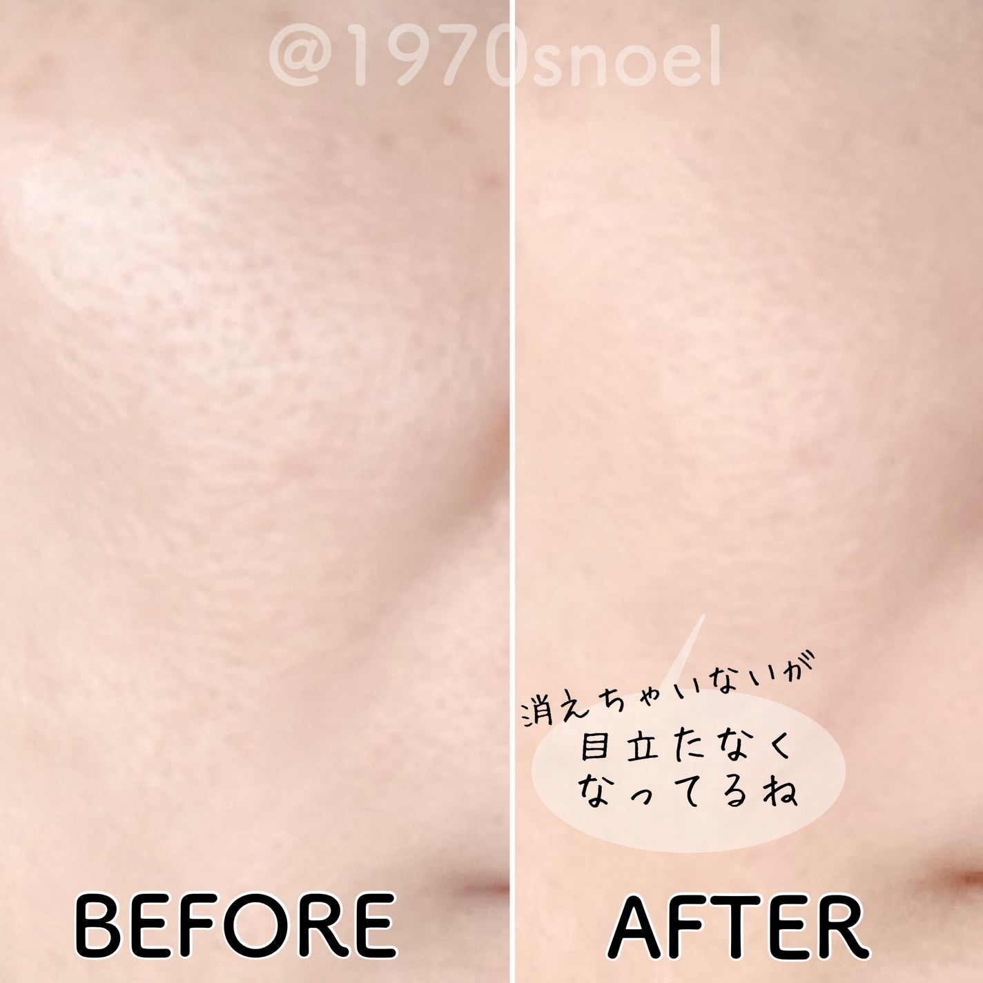 プレストパウダー C/ポイントマジックPRO/プレストパウダーを使ったクチコミ(3枚目)