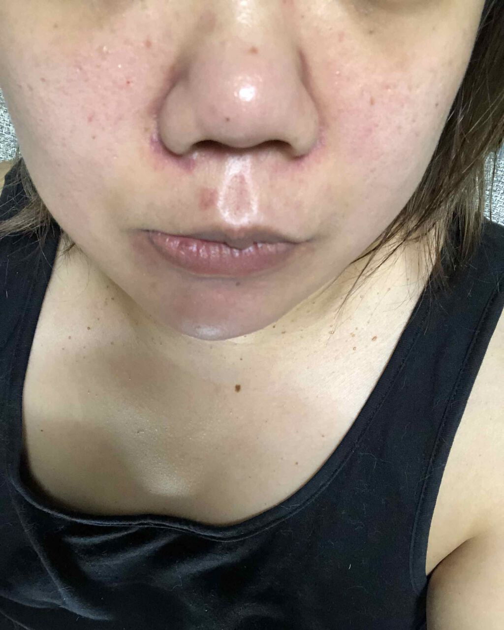 ♡みやび♡ on LIPS 「自分へのご褒美に毛穴汚れ吸引器買いました♡届いて使ってみたとこ..」(3枚目)