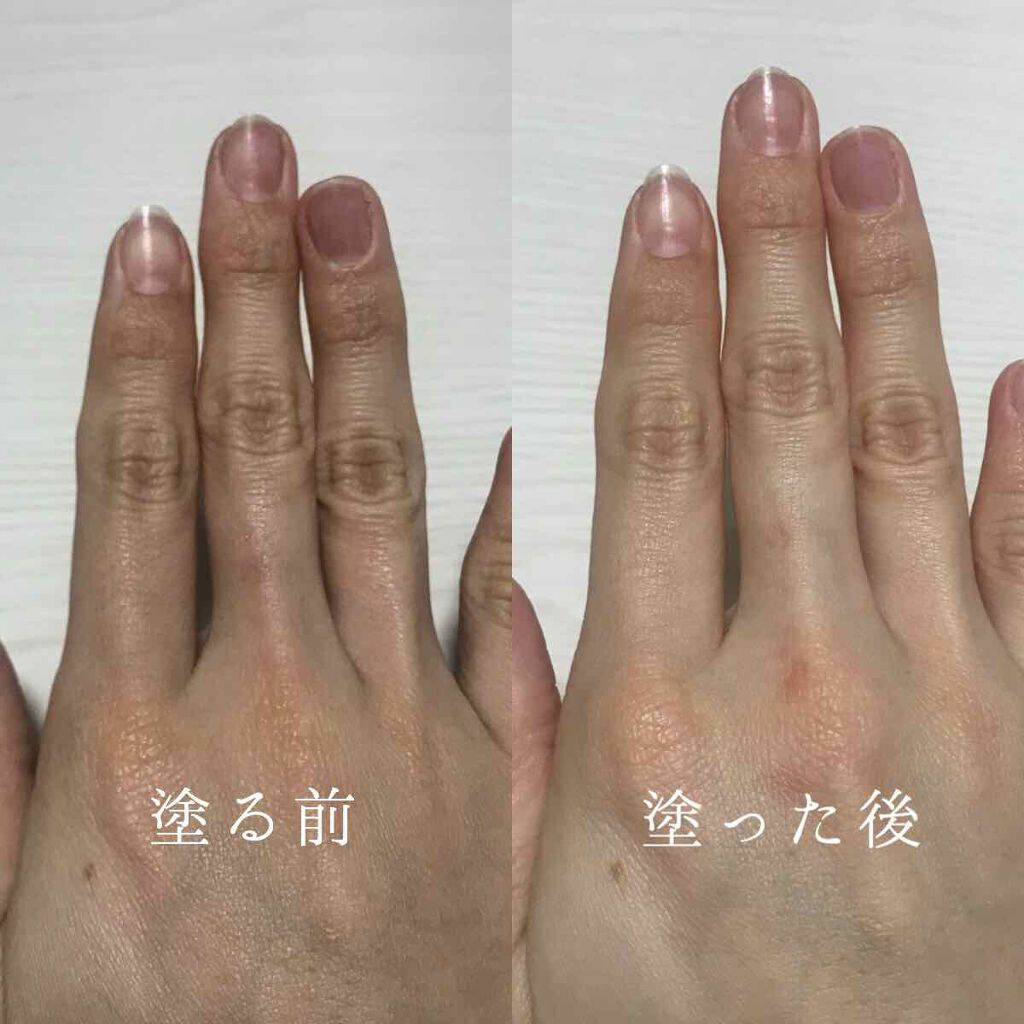 ユースキンA ファミリーメディカルクリーム/ユースキン/ハンドクリームを使ったクチコミ（2枚目）