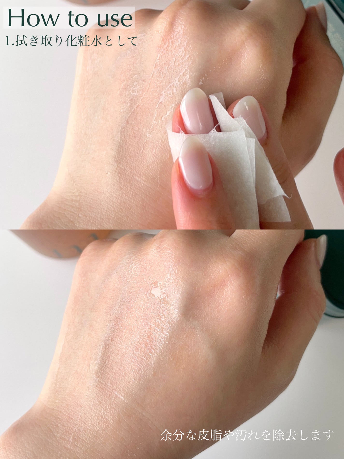 アーチチョーク スージング アクニ ポア トナーパッド/molvany/トナーパッドを使ったクチコミ(4枚目)