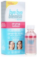 Drying Lotion / byebyeblemish