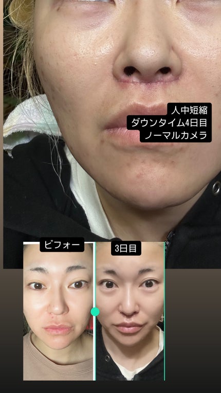 5児ママ ゆかこ♡フォロバ100 コメください on LIPS 「@haab_dream様のプロモーションに参加しています♡投稿..」(6枚目)