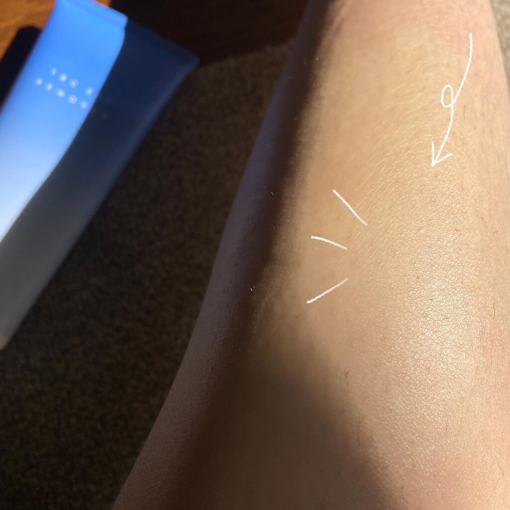 エピリムーバー N/TBC/除毛クリームを使ったクチコミ(6枚目)