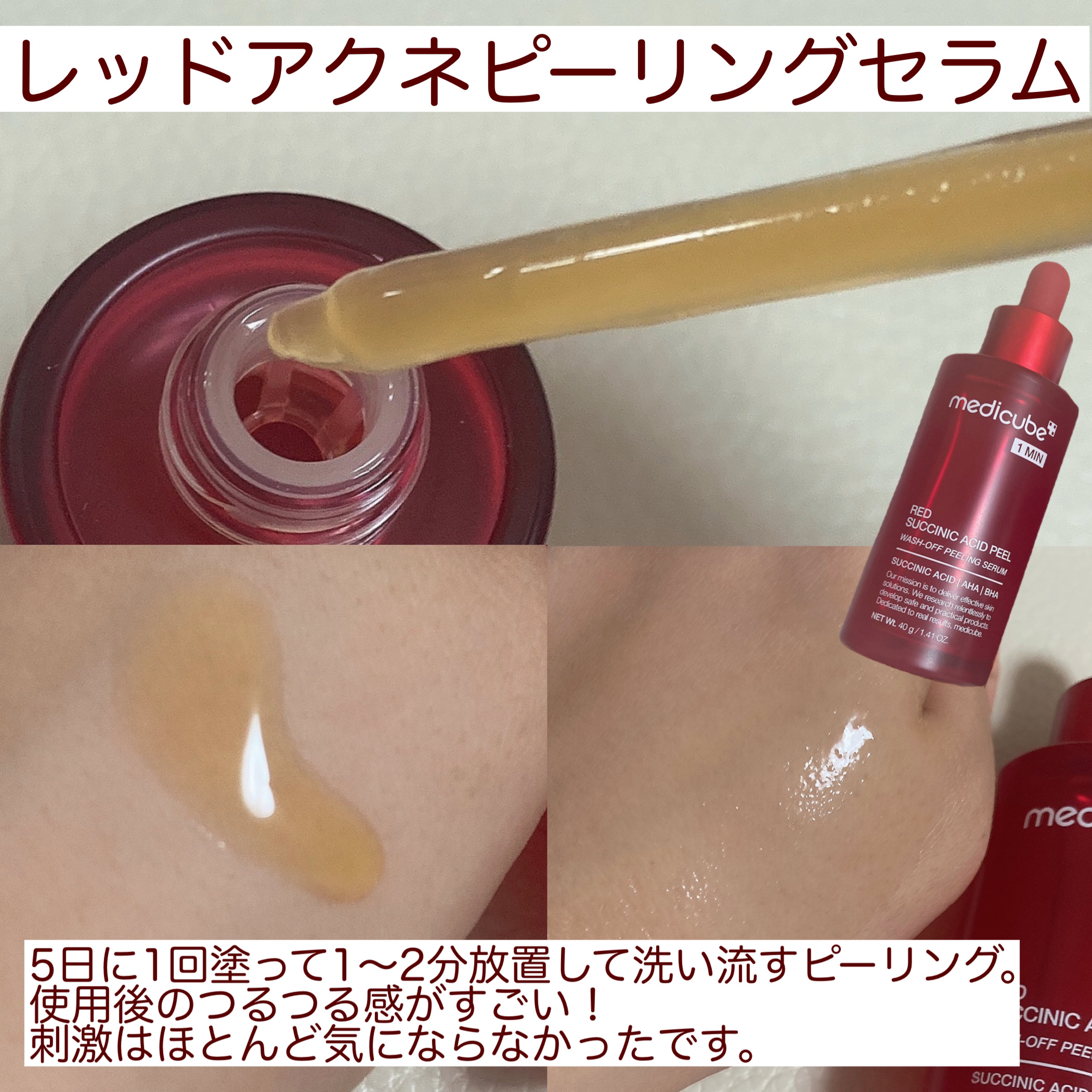レッドアクネピーリングセラム/MEDICUBE/美容液を使ったクチコミ（3枚目）