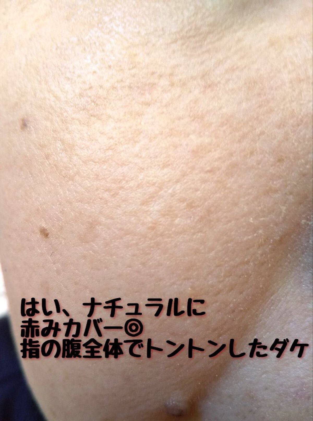 マスクフィットオールカバーデュアルコンシーラー/TIRTIR(ティルティル)/コンシーラーを使ったクチコミ(8枚目)