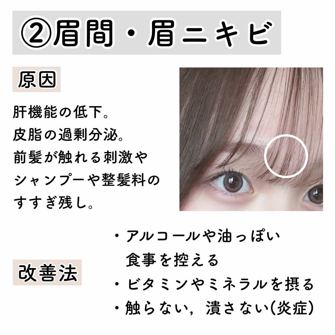 明色美顔水 薬用化粧水/美顔/化粧水を使ったクチコミ(3枚目)