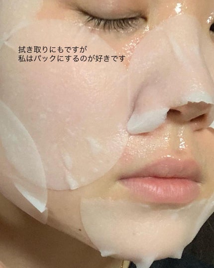 カロテンIPMP(TM) ブレミッシュカーミングセラムパッド/APRILSKIN/トナーパッドを使ったクチコミ(4枚目)